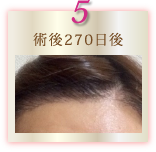 術後270日後