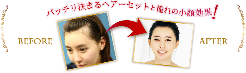 バッチリ決まるヘアーセットと憧れの小顔効果