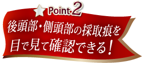 後頭部・側頭部の採取痕を目で見て確認できる！