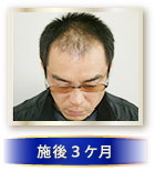 施後３ケ月