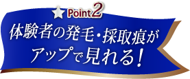 体験者の発毛・採取痕がアップで見れる！
