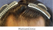 MotionClinic