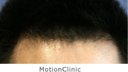 MotionClinic