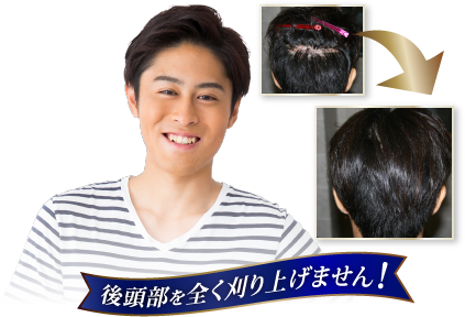 後頭部を全く刈り上げません！