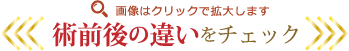 術前後の違いをチェック