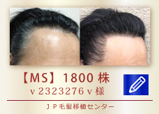 【MS】1800株