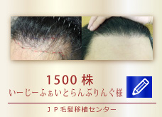 1500株