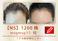 【NS】1200株