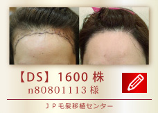 【DS】1600株