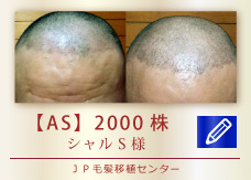 【AS】2000株