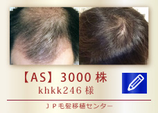 【AS】3000株