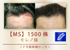 【MS】1500株