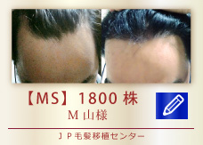 【MS】1800株