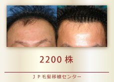 2200株