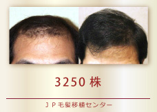 3250株