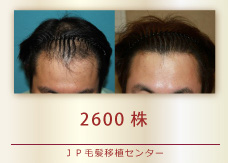 2600株