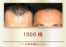 1000株