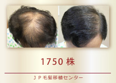 1750株