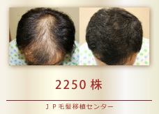 2250株