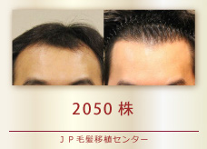 2050株