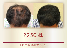 2250株