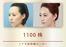1100株
