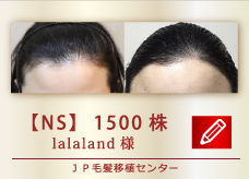 【NS】　1500株