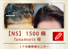 【NS】　1500株