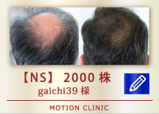【NS】　2000株