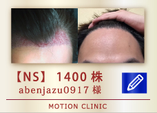 【NS】　1400株