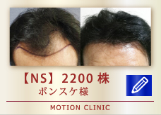 【NS】　2200株