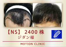 【NS】　2400株