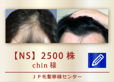 【NS】　2500株