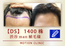 【DS】　1400株