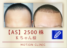 【AS】2500株