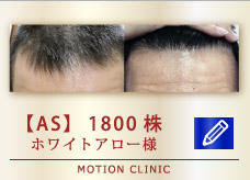 【AS】　1800株