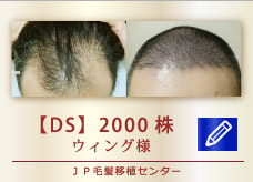 【DS】　2000株