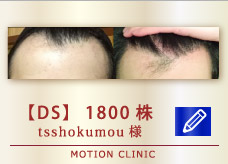 【DS】　1800株