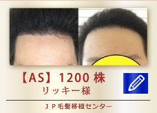 【AS】1200株