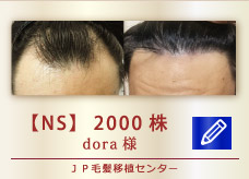 【NS】2000株