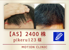 【AS】2400株