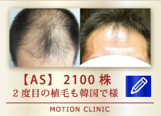 【AS】2100株
