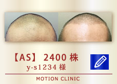 【AS】2400株