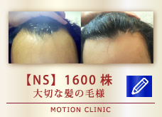【NS】1600株