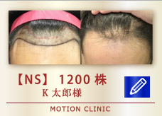 【NS】1200株