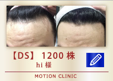 【DS】1200株