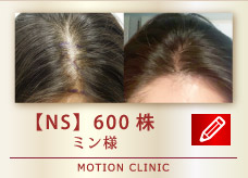 【NS】600株