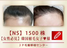 【NS】1500株