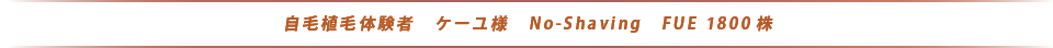 自毛植毛体験者　ケーユ様　No-Shaving　FUE　1800株
