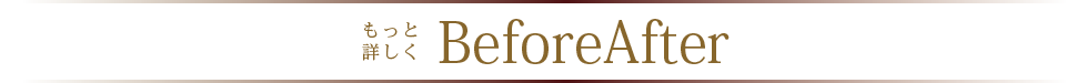 BeforeAfter